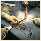 超音波凝固切開装置 Ethicon Endo-Surgery,Inc.ハーモニックスカルペル
